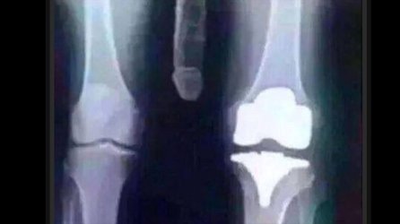 knee.JPG